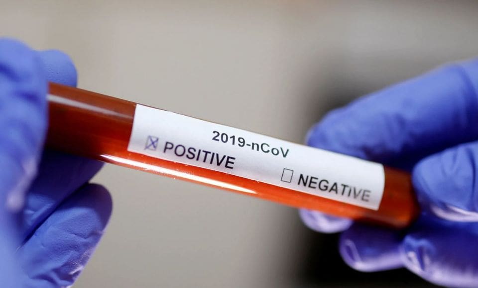 teste covid