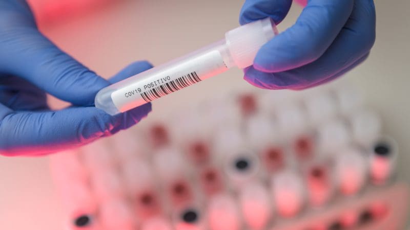 teste coronavírus