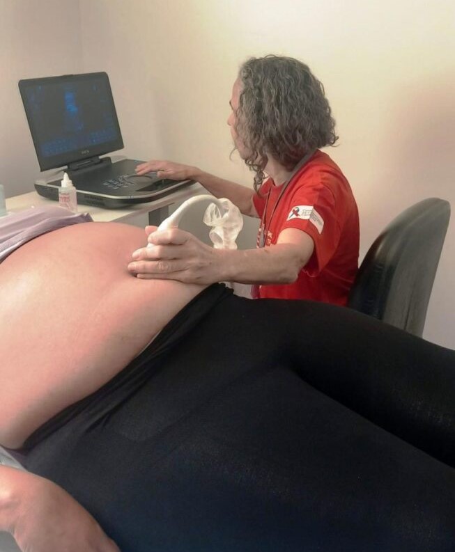 Mutirão de ecocardiogramas fetais do Hemu realiza 78 exames
