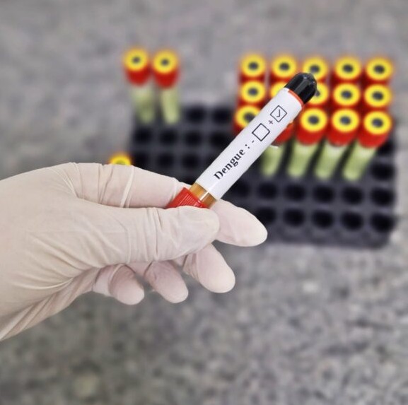 HDT reforça cuidados contra a dengue com o período chuvoso